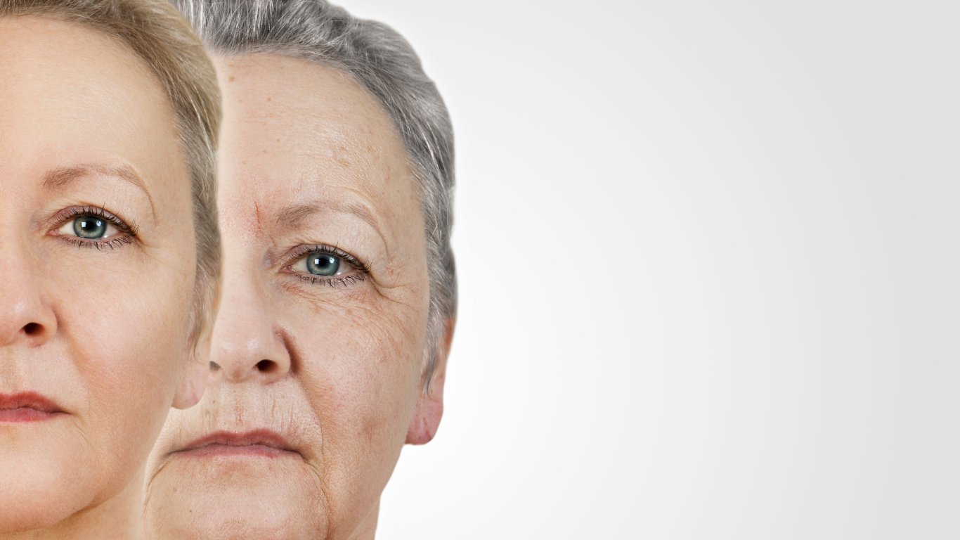 Upper Face Wrinkle