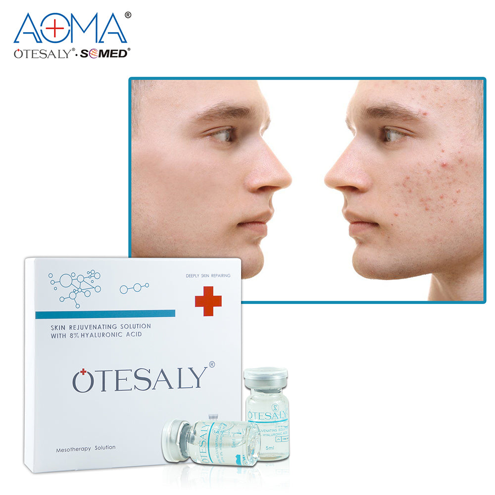 Otesaly Mesotherapy